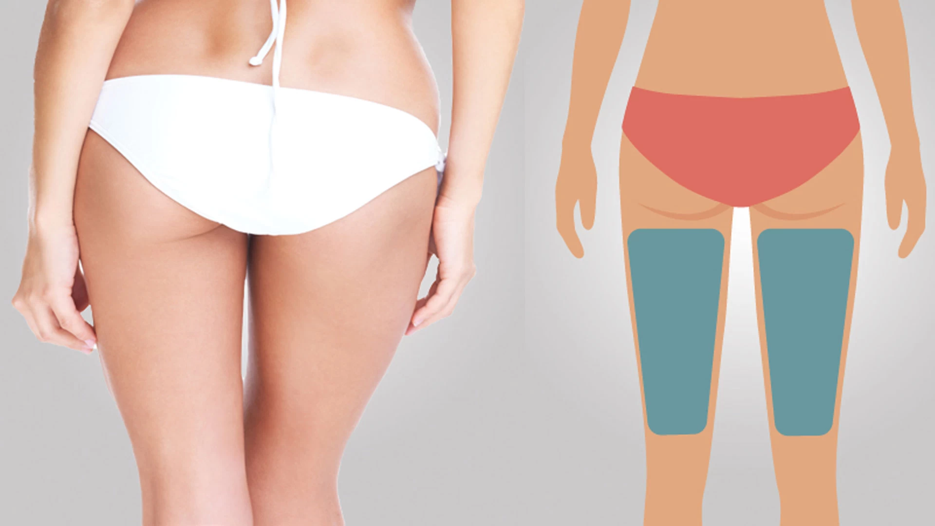 Depilação Posterior Coxa