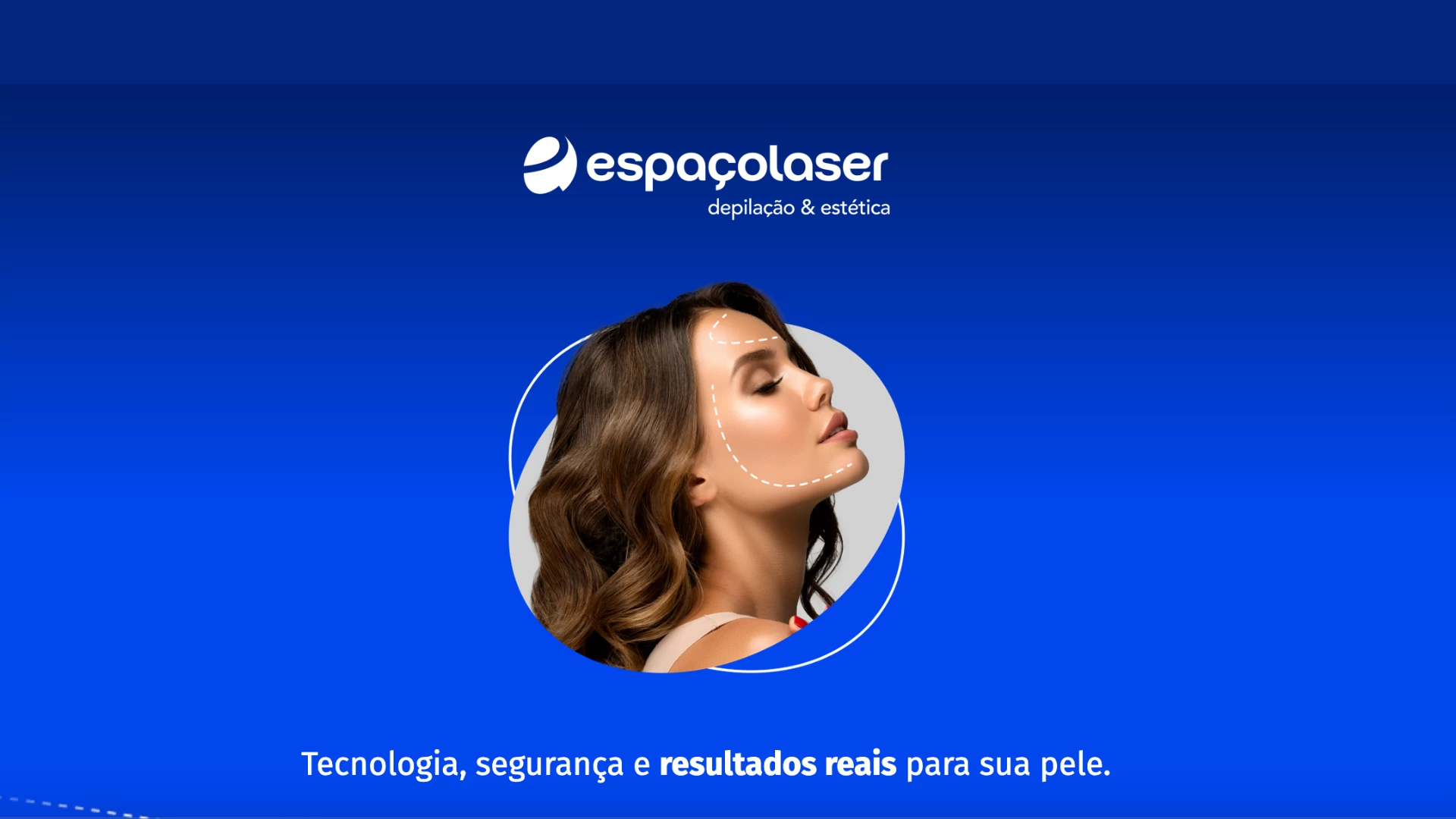 Espaçolaser
